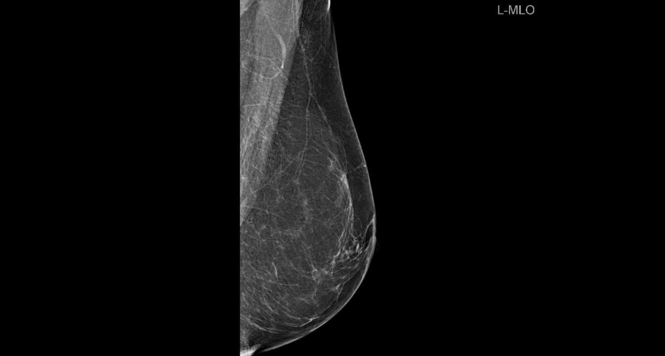 Zakažite preventivni pregled dojke u poliklinici Affidea Vita! 