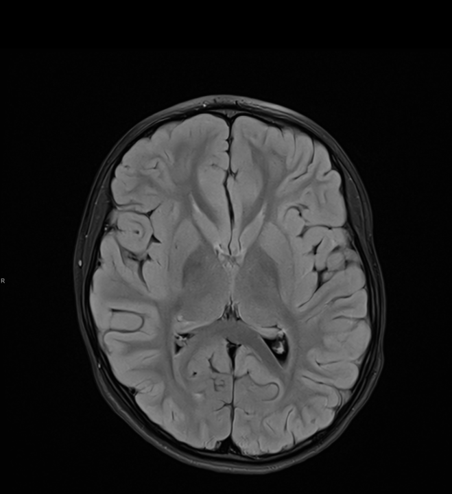 Tijekom Tjedna mozga Poliklinika Affidea Vita daje 20 posto popusta na magnetsku rezonancu!
