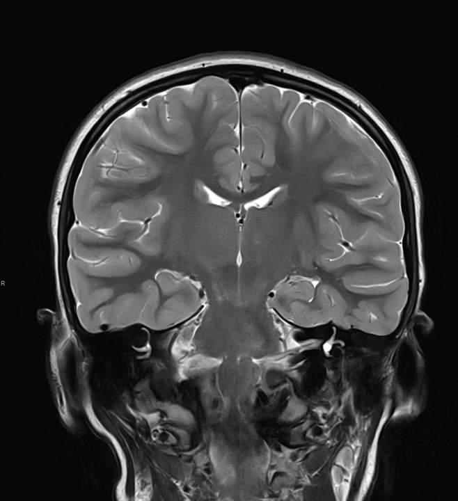 Tijekom Tjedna mozga Poliklinika Affidea Vita daje 20 posto popusta na magnetsku rezonancu!