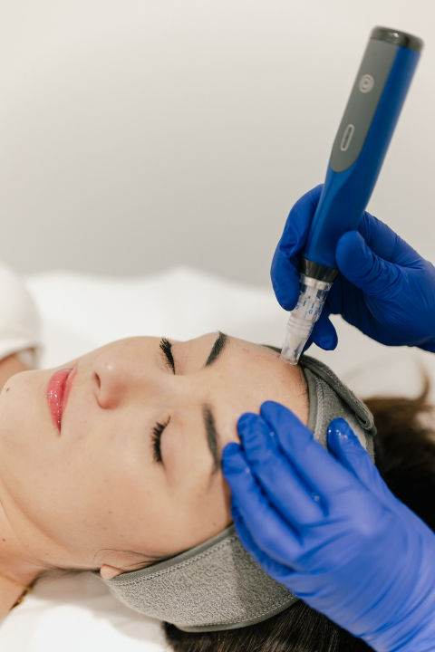 Obnovite svoju kožu vrhunskim dermatološkim tretmanima Poliklinike Krešimir