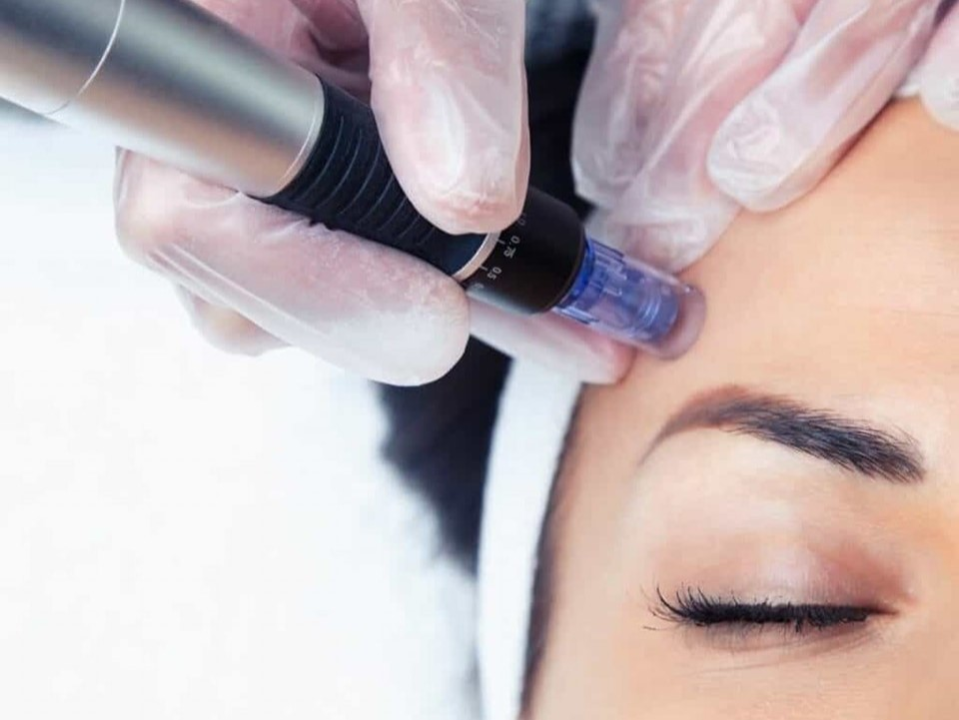 FOTO Poliklinika Gemini pruža revolucionaran pristup zdravlju kože i to uz 20 posto popusta!