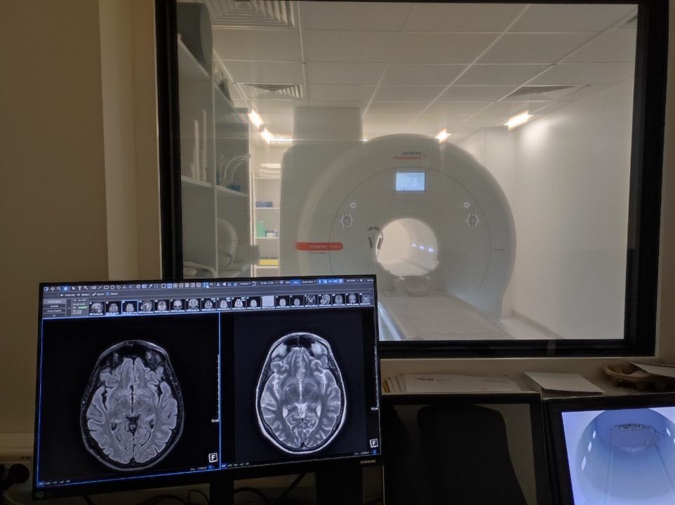 FOTO Dr. Ivan Miletić iz Poliklinike Pupillam: Moždani udar, kako što ranije otkriti aterosklerozu kao uzrok