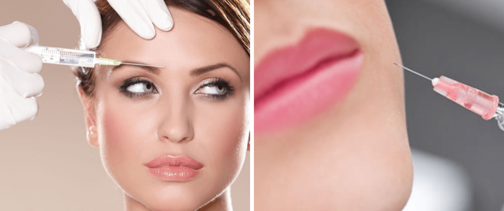 FOTO Proljetna revolucija kože: Zašto su Dermaroller i PRP dobitna kombinacija za vaš novi sjaj?