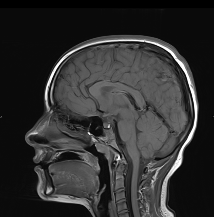 FOTO Iskoristite popust na MR mozga u Affidei Vita: Ne čekajte da zaboravljanje postane problem!