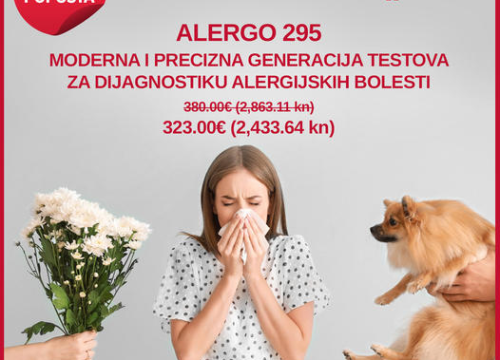 Fotografija 3 - Muče vas simptomi alergije? Pravo je vrijeme da napravite alergijski test u Poliklinici Analiza!